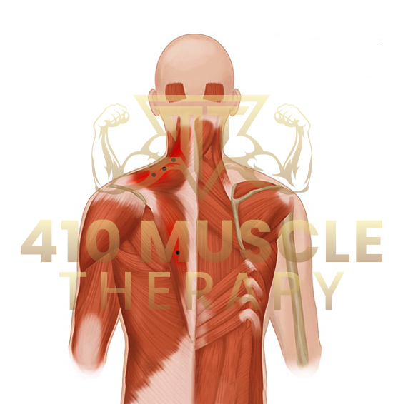 Conditions Treated with Myofascial Release
