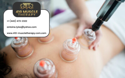 What Is Cupping Therapy & How It Works