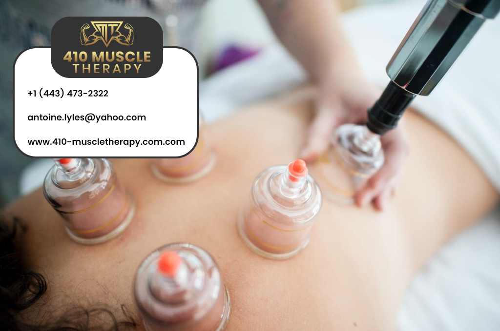 What Is Cupping Therapy & How It Works