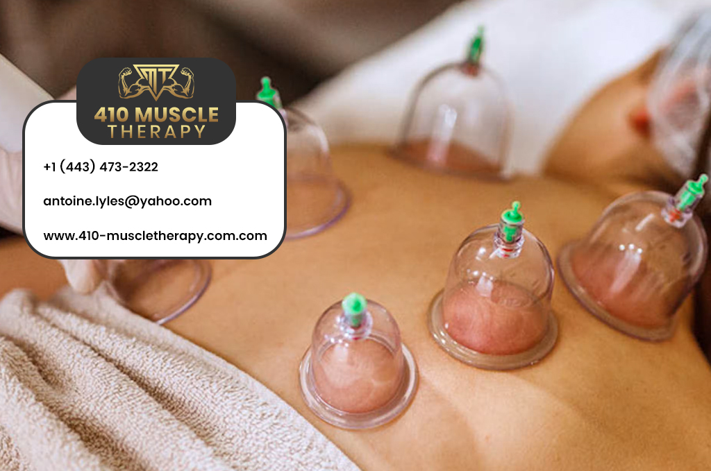 Types of Cupping Therapy